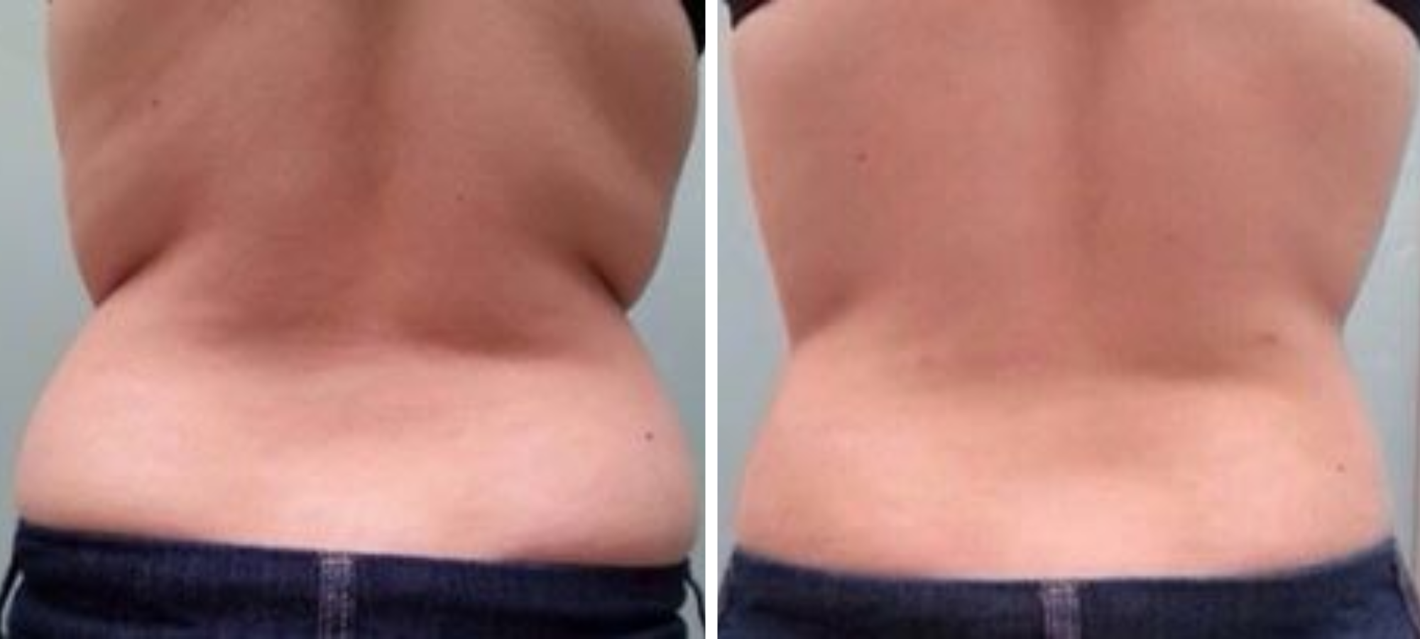 rmc-tightsculpting1